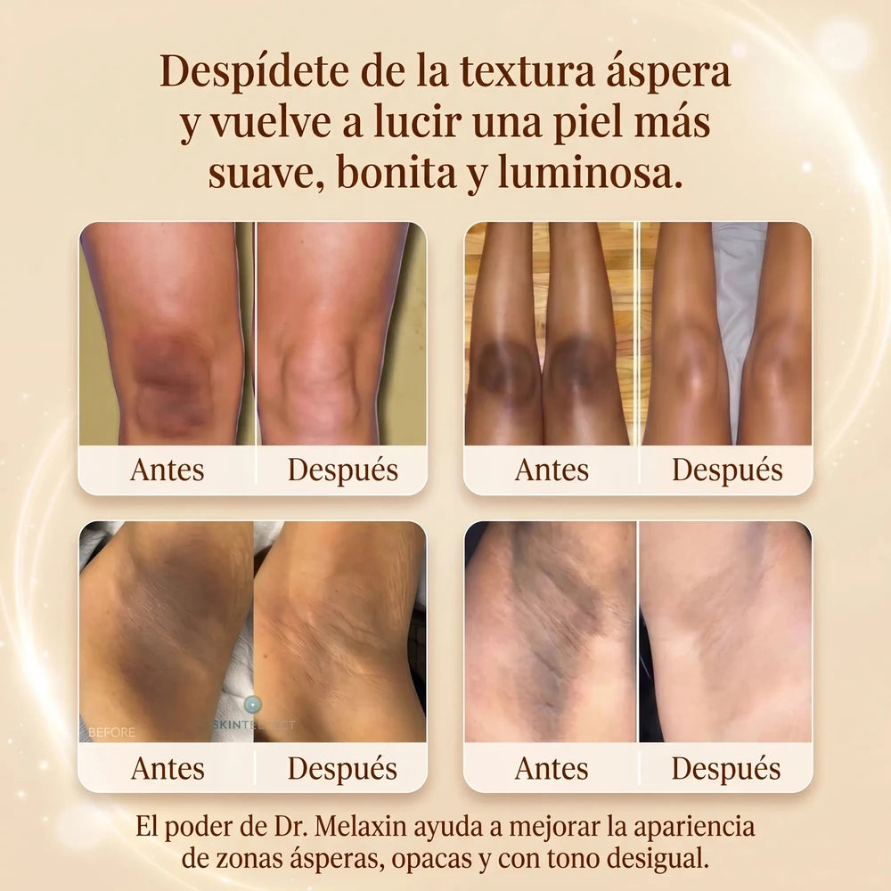 💣 ¿AXILAS Y ENTREPIERNA OSCURAS? 😩 | RECUPERA TU CONFIANZA ✨ | 2X1 SOLO POR HOY A $899 🔥 + EBOOK GRATIS 🎁