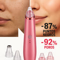 Limpiador poros facial aspirador puntos negros 5 cabezales USB recargable - imagen 4