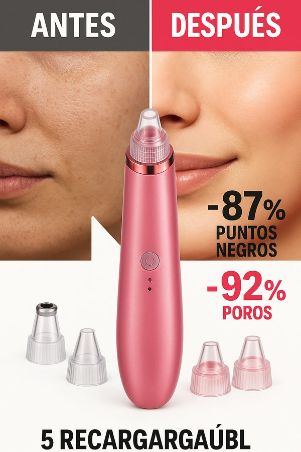 Limpiador poros facial aspirador puntos negros 5 cabezales USB recargable - imagen 4
