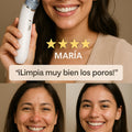 Limpiador poros facial aspirador puntos negros 5 cabezales USB recargable - imagen 6
